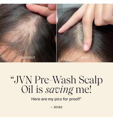 *SOBRE PEDIDO* Mini Complete Pre-Wash Scalp & Hair Strengthening Treatment Oil